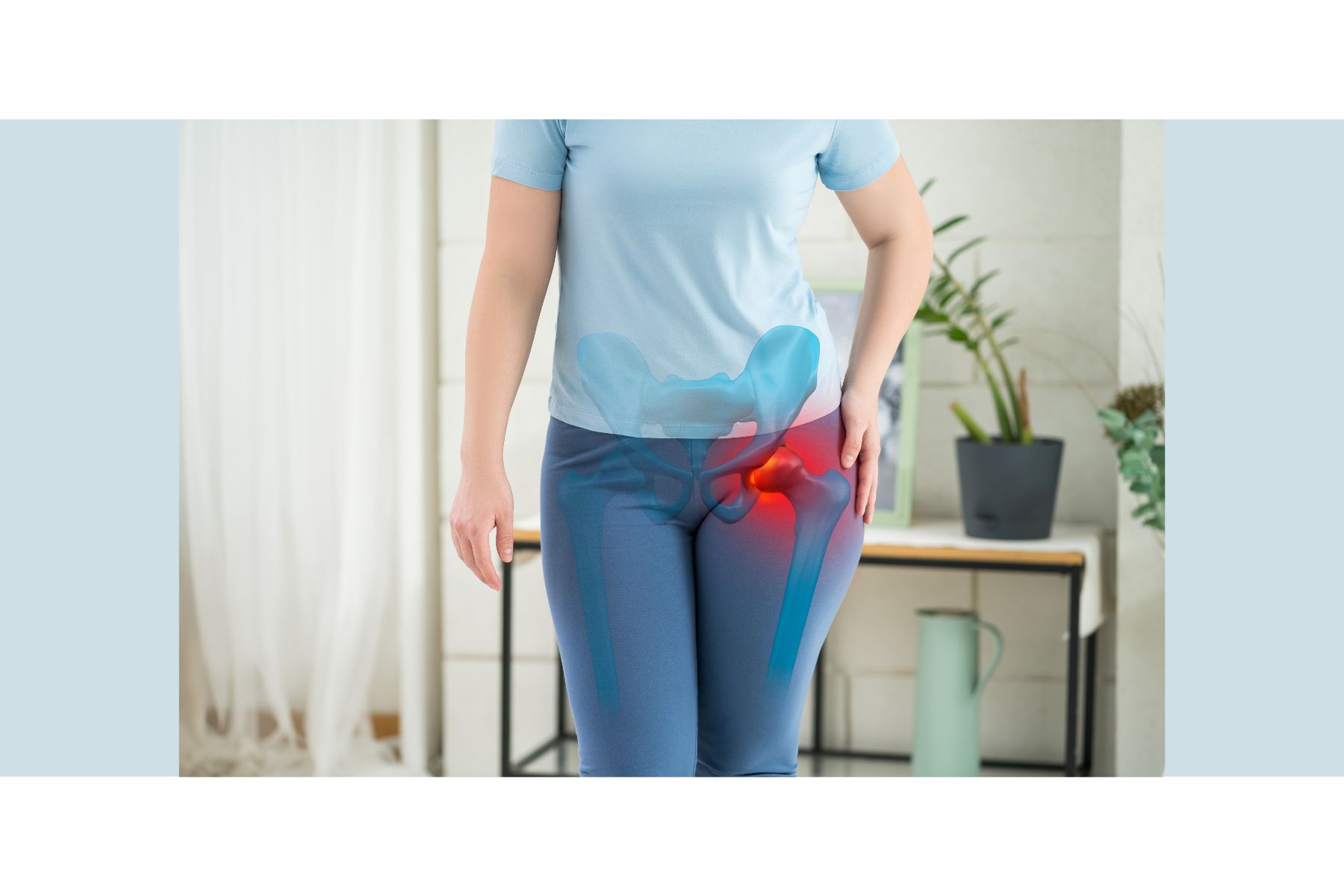 Bursitis trocantérea